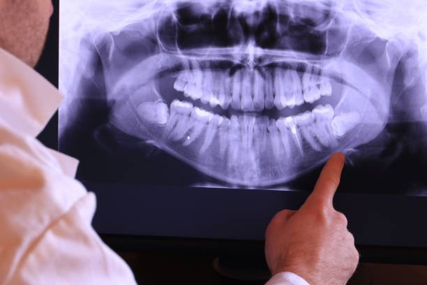 Best Emergency Treatment for Jaw Pain or Injury in Westbury, NY